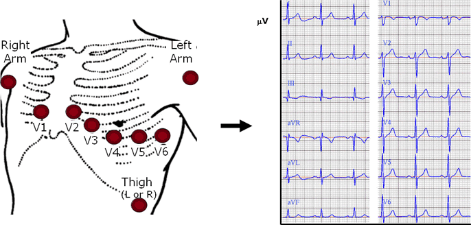 Điện tâm đồ ECG